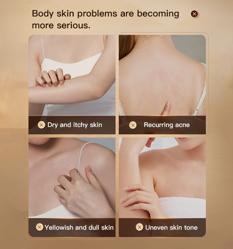 clobetasol cream benefits