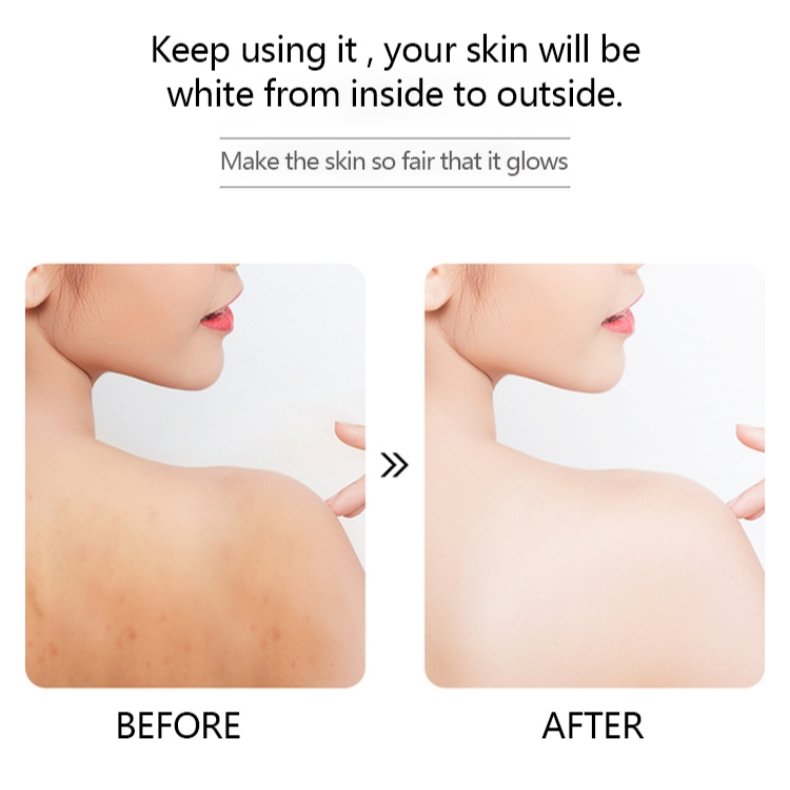 prevents Ingrown Hairs and Body Acne