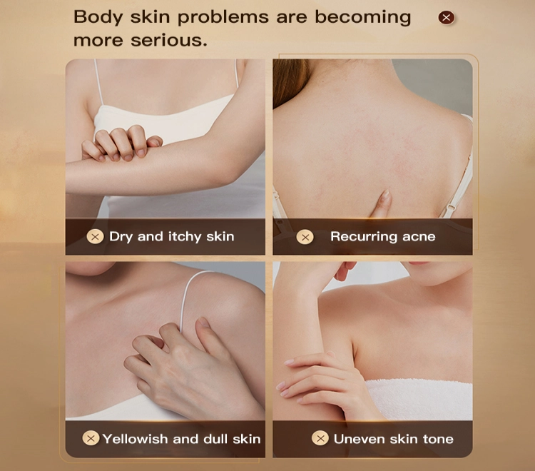 benefit of clobetasol cream