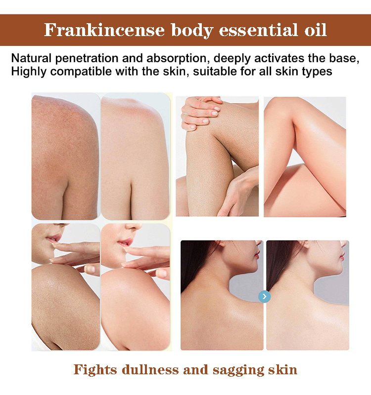 benefit of frankincense oil