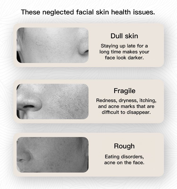 goat milk cream for dry skin