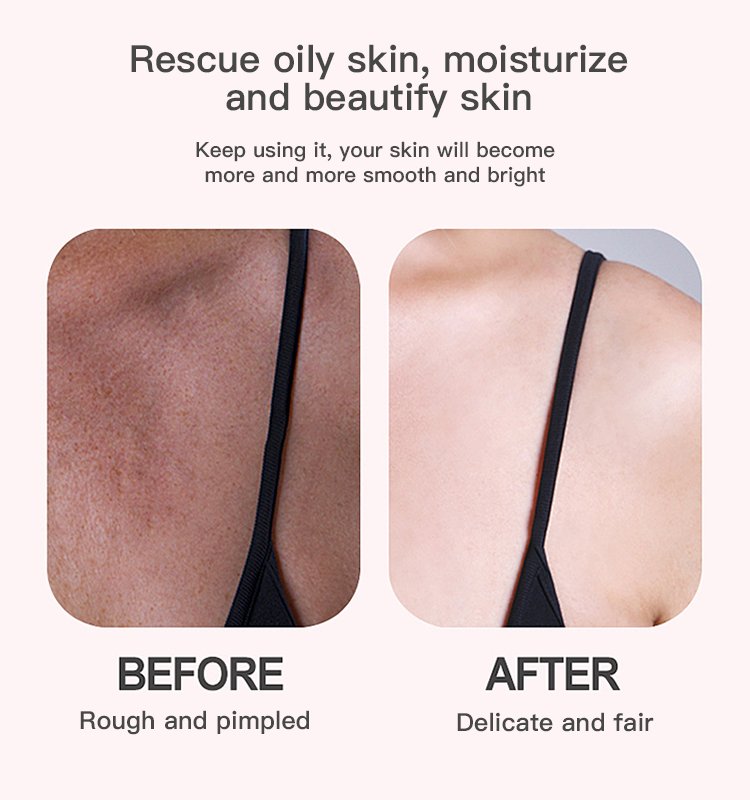 strawberry essential oil for all skin tones