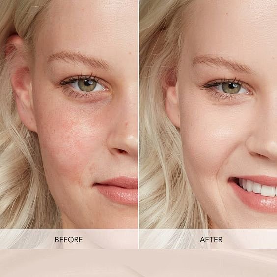 Improve skin tone