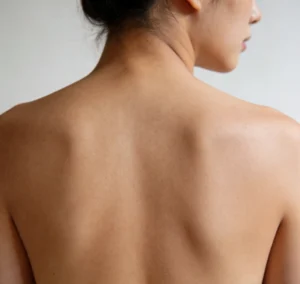 kojic soap for normal skin