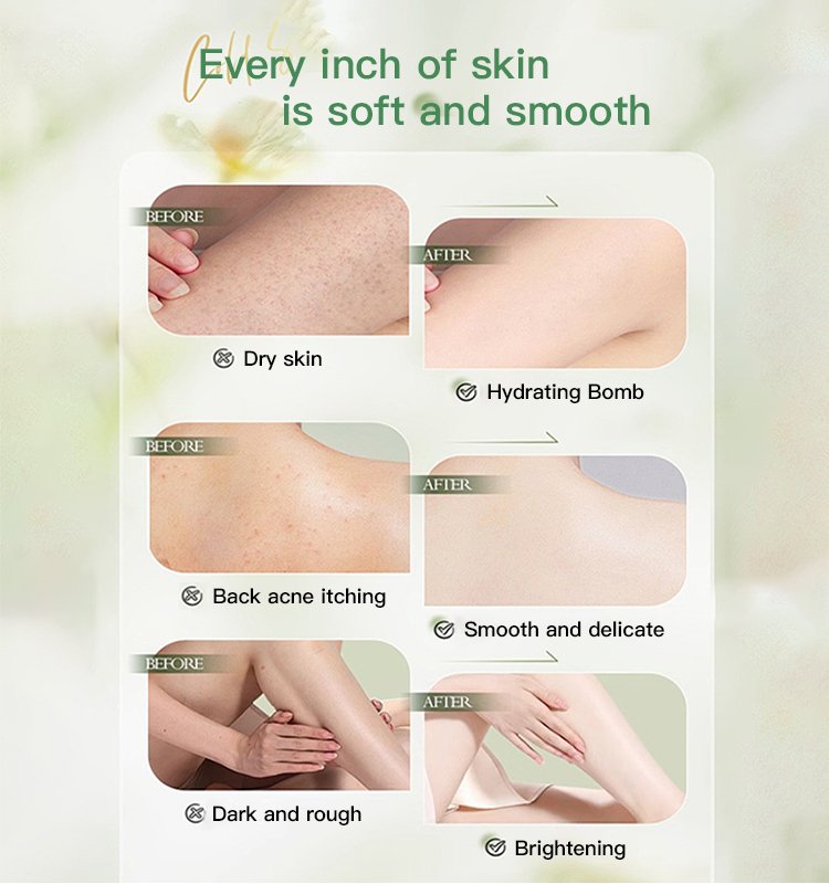 lemongrass essential oil benefits