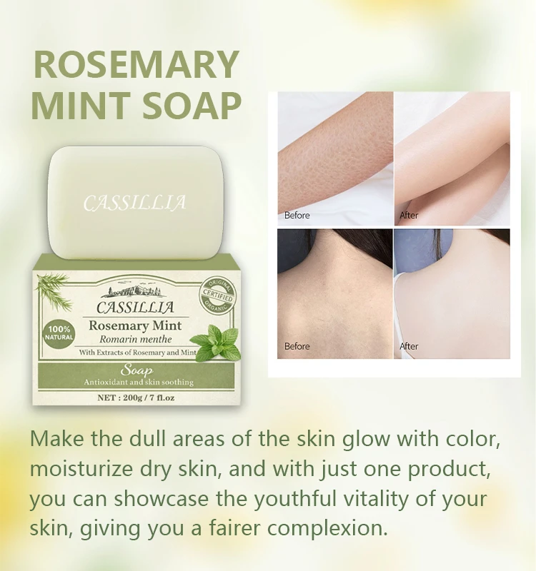 rosemary and mint soap benefits